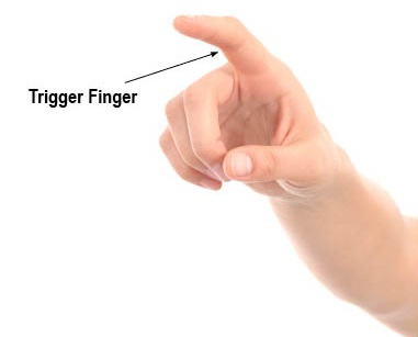 What is a Trigger Finger?: Orthopaedic Associates